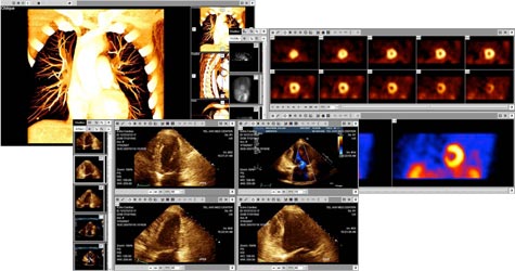 Cardiology Imaging Screens