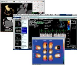 Cardiac Imaging Software Screens